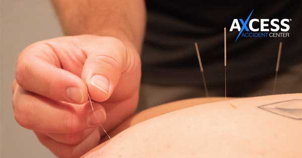 acupuncture blog image